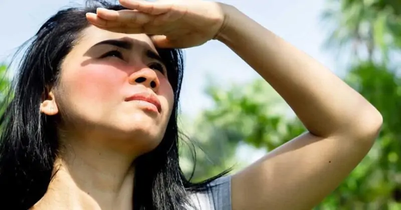 Ánh nắng mặt trời làm trầm trọng thêm tình trạng sạm da