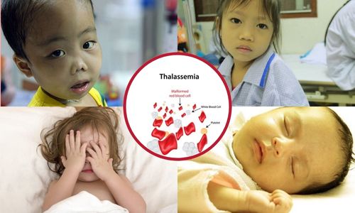 Mẹ bầu mang gen Thalassemia có nên uống sắt không