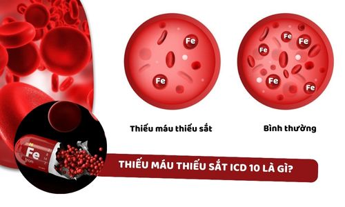 thiếu máu thiếu sắt icd 10