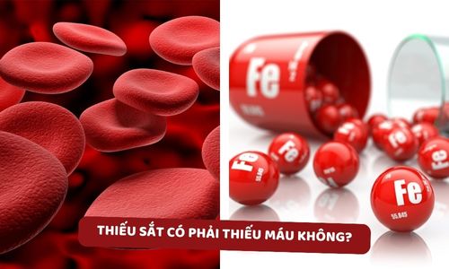 Thiếu sắt có phải là thiếu máu không