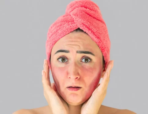 Ba bau bi di ung da mat Nguyen nhan va cach xu ly an toan don gian ngay tai nha