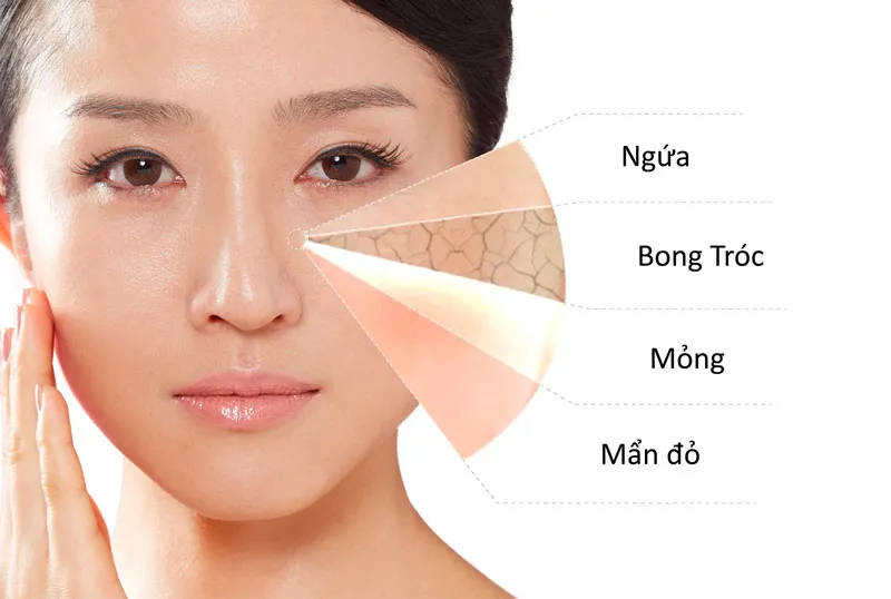 Biểu hiện cho thấy da nhạy cảm