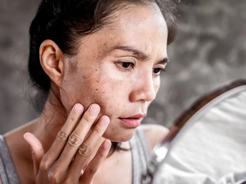 mẹ bầu phơi nắng có tốt không