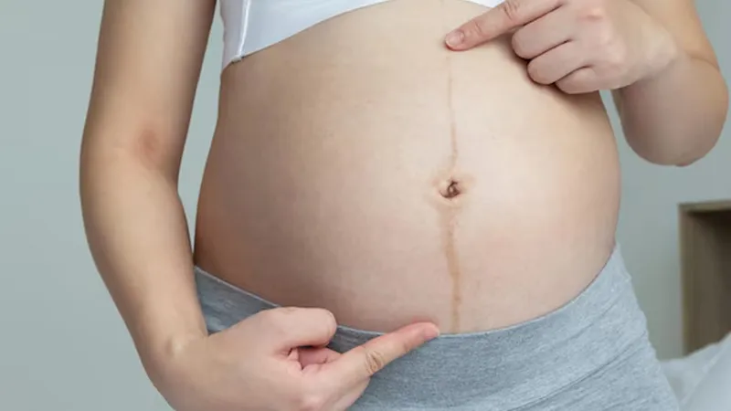 Da thay đổi khi mang thai phải làm sao