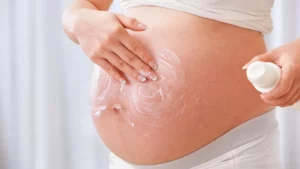 phòng ngừa rạn da từ sớm