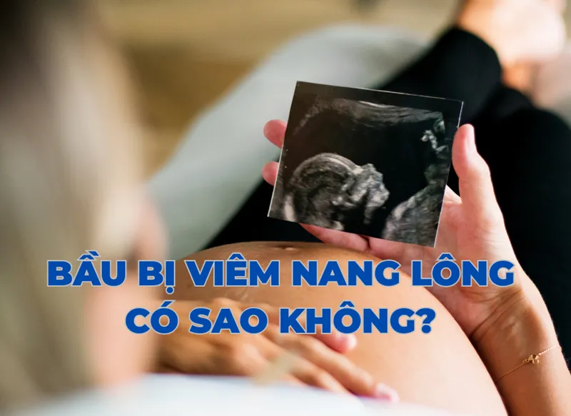 Viêm nang lông là gì?