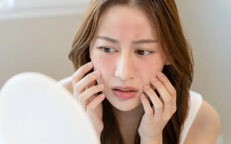 Dau hieu nhan biet lan da nhay cam