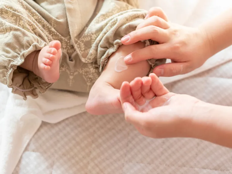 Cách xử lý da bé bị nổi sần như da gà chuẩn chuyên gia