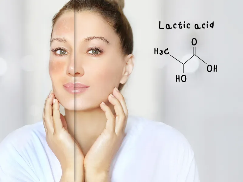 Acid lactic là gì?