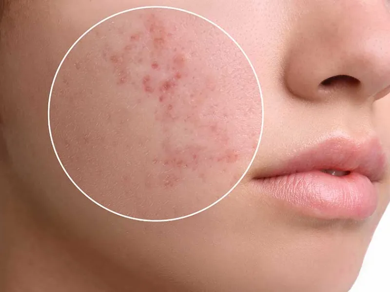 Củ gừng có tác dụng gì? Lợi ích cho làn da