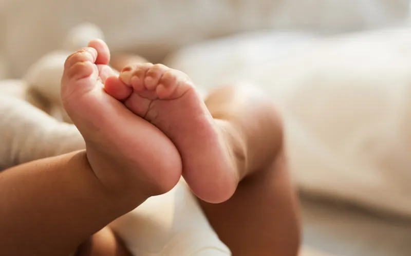 Dấu hiệu nhận biết da chân bé bị khô sần