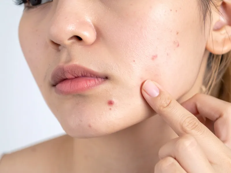 Công dụng của Sodium Ascorbyl Phosphate trong mỹ phẩm