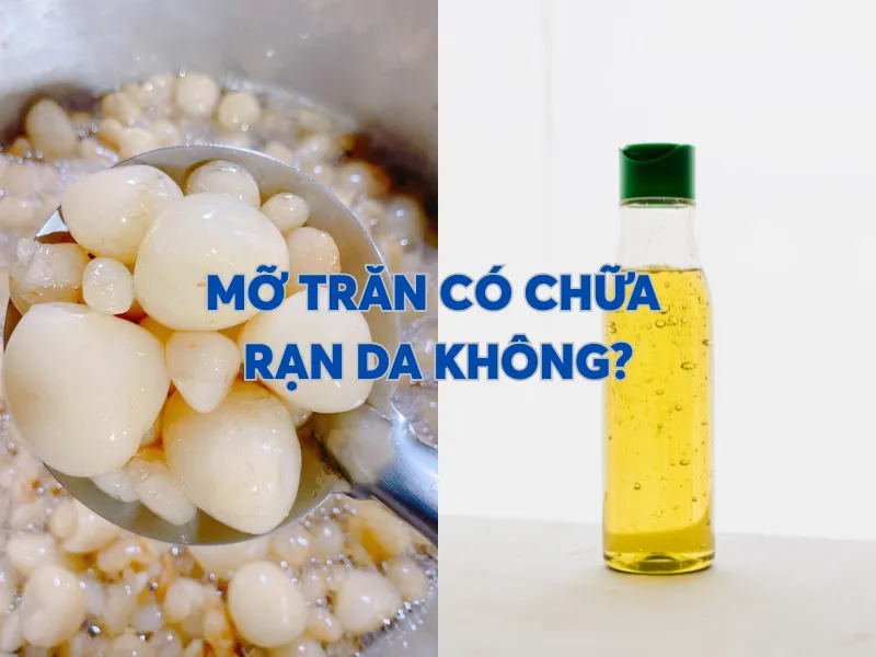 Mỡ trăn có chữa rạn da không?