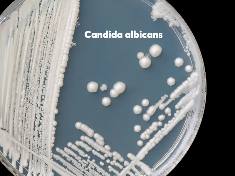 Nguyên nhân nấm da ở trẻ sơ sinh