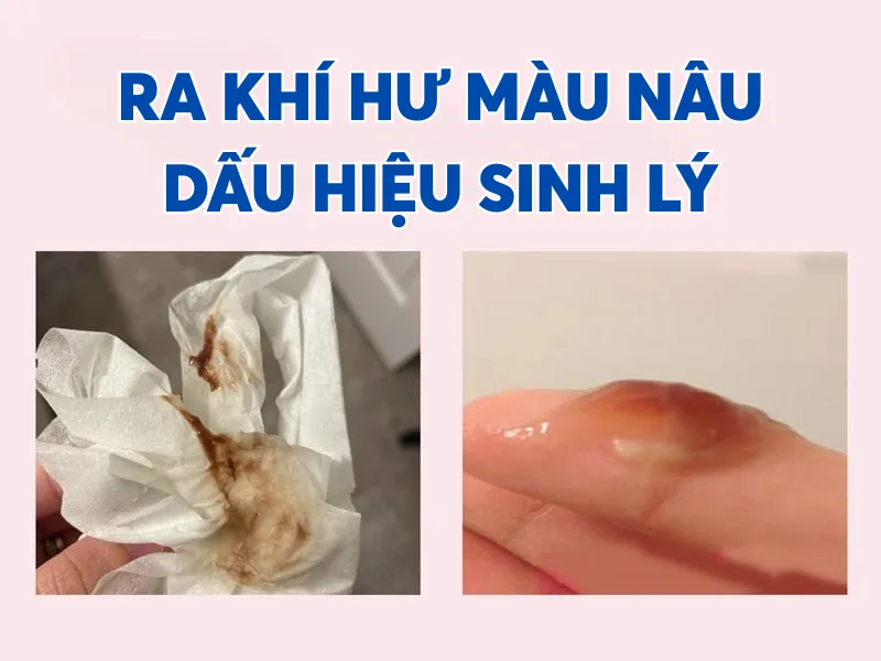 Dấu hiệu sinh lý