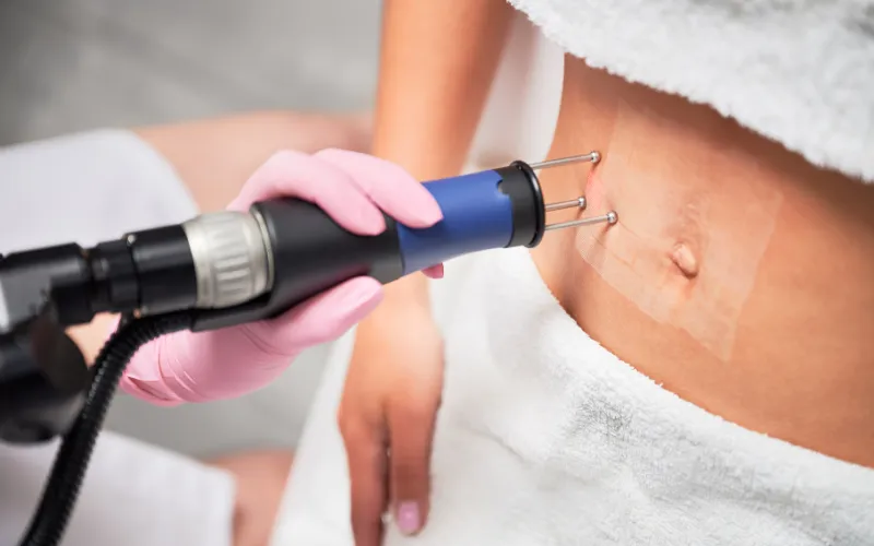 Điều trị bằng Laser Fractional CO2