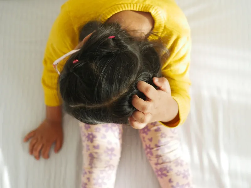 Dấu hiệu nhận biết sớm nấm da đầu ở trẻ em