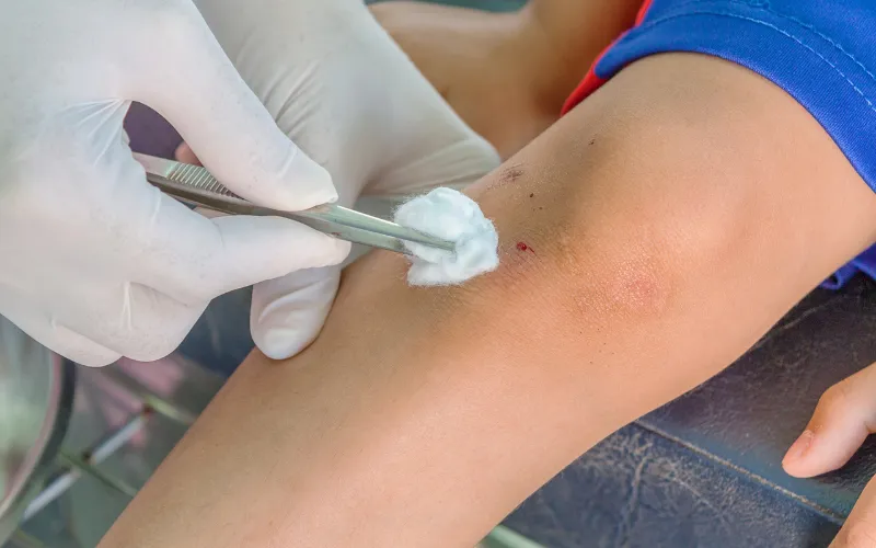 Khi nào nên đưa trẻ đến bác sĩ