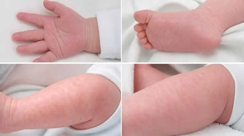 Hệ thống mạch máu và thần kinh chưa hoàn thiện