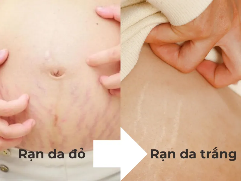 Vì sao rạn đỏ rồi mới thành rạn trắng?