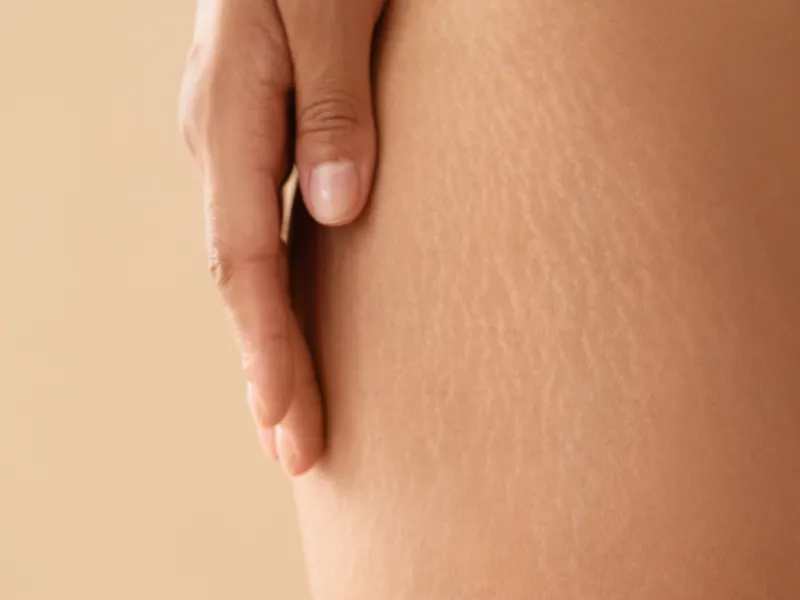 Rạn đỏ hay rạn trắng: giai đoạn nào “dễ chữa” hơn?