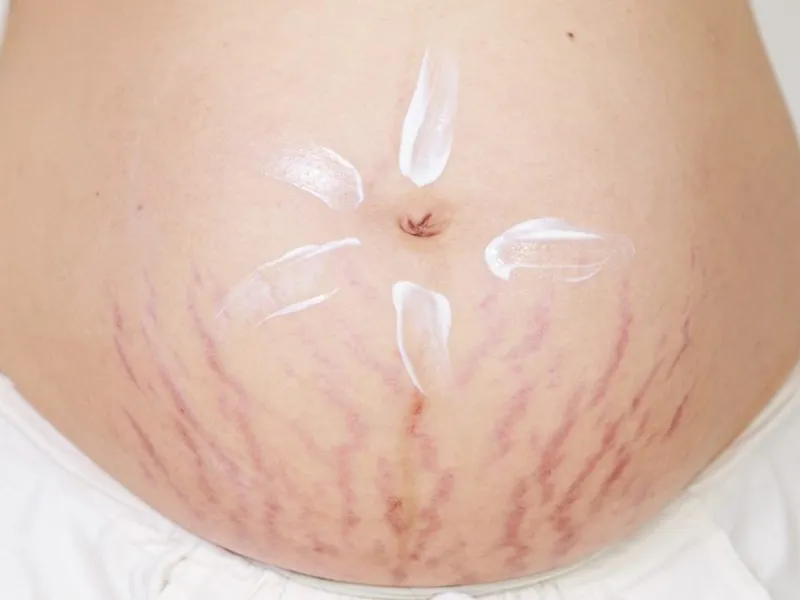 Dưỡng ẩm và massage đúng cách