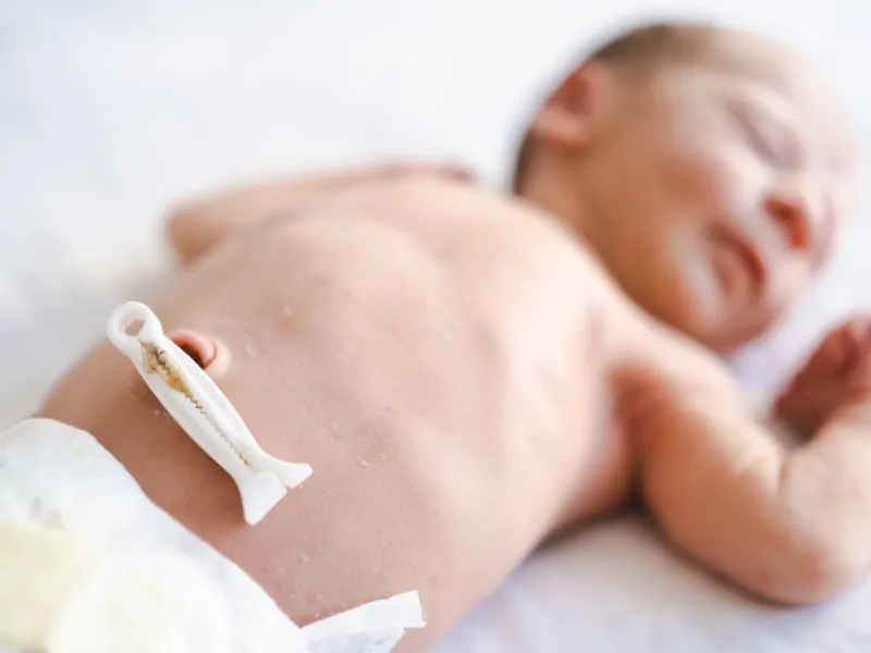 Rốn trẻ sơ sinh bao lâu thì rụng?