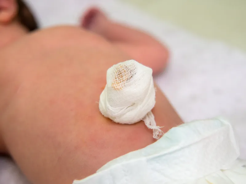 Dấu hiệu rốn trẻ sơ sinh bất thường cần đi khám