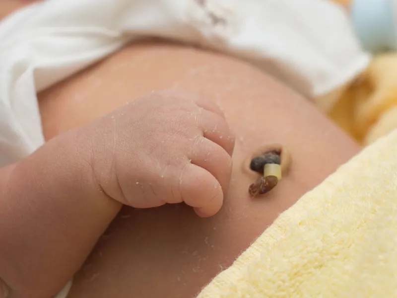 Nguyên tắc vệ sinh rốn cho trẻ sơ sinh