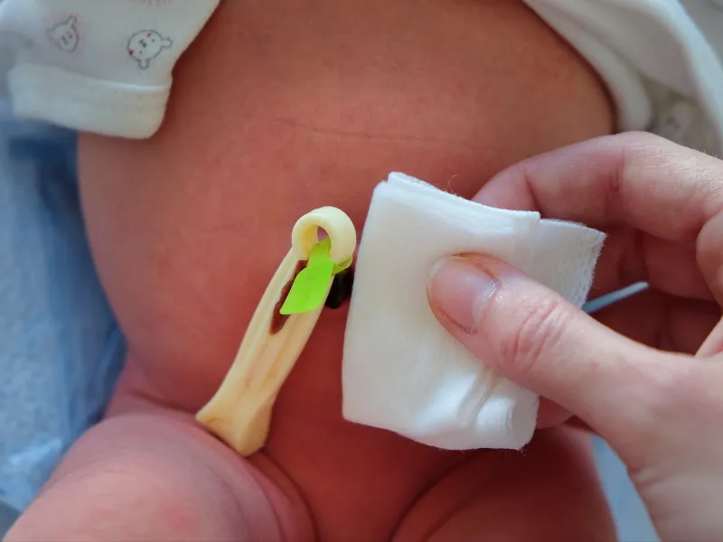 Chuẩn bị trước khi vệ sinh rốn cho trẻ sơ sinh