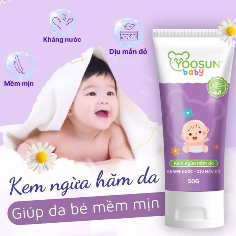 Bé bị dị ứng bỉm bôi kem gì. Yoosun Baby – Lựa chọn kinh tế, dễ mua tại Việt Nam