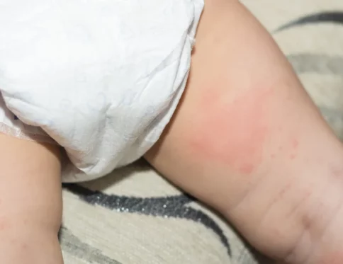 be-bi-di-ung-bim-boi-kem-gi