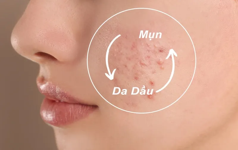 chọn màng lọc lành tính theo từng loại da