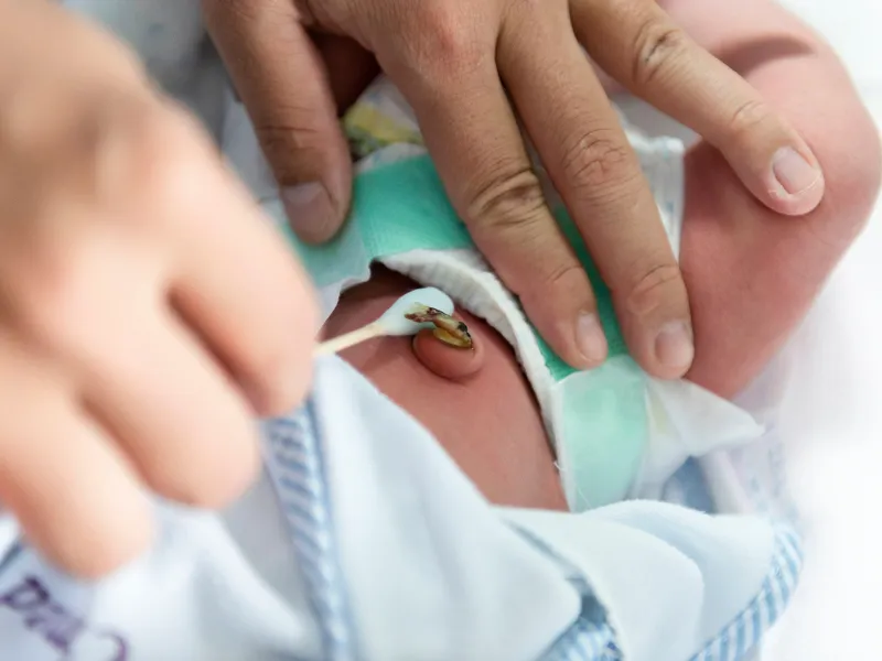 Vì sao không nên tắm trẻ sơ sinh mỗi ngày?