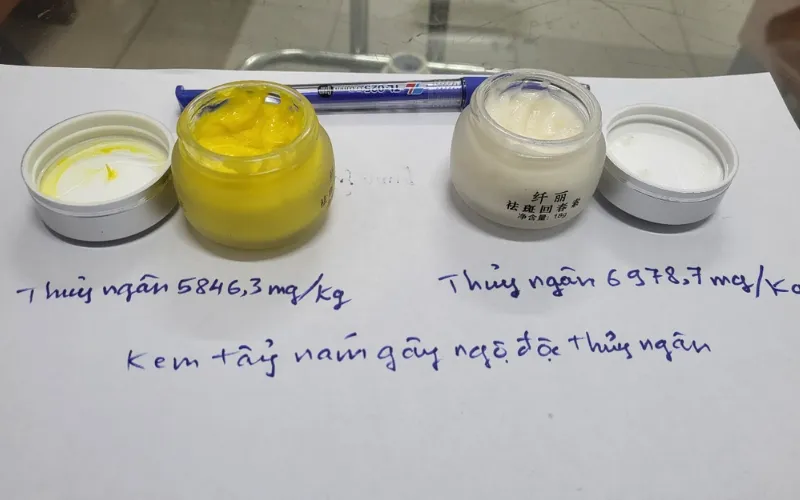 Thủy ngân – chất độc hại cho hệ thần kinh