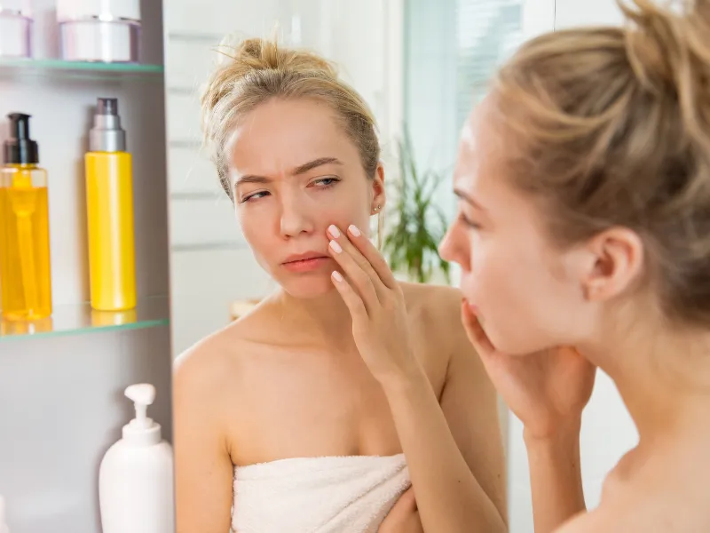 Dị ứng kem chống nắng là gì?