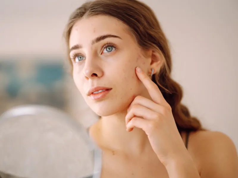 Công dụng của dimethicone trong kem chống nắng