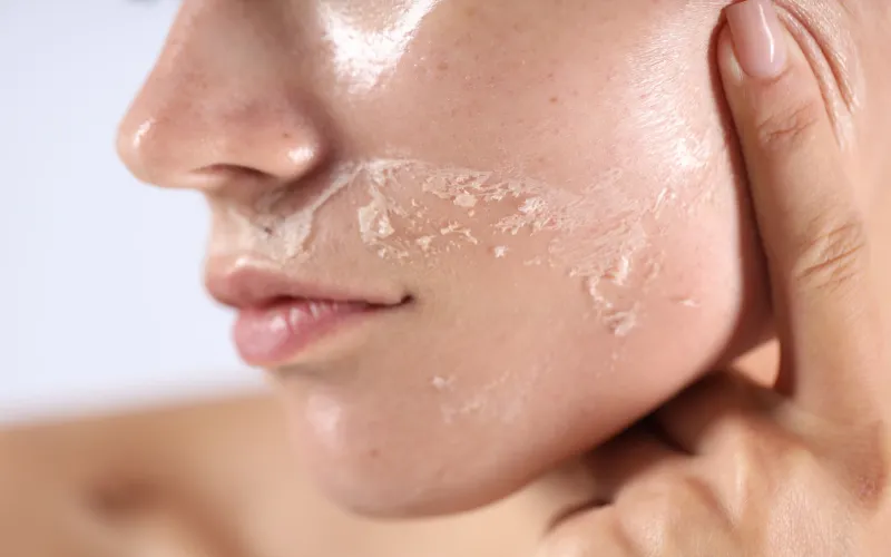 Phản ứng của hàng rào bảo vệ da với nồng độ hoạt chất