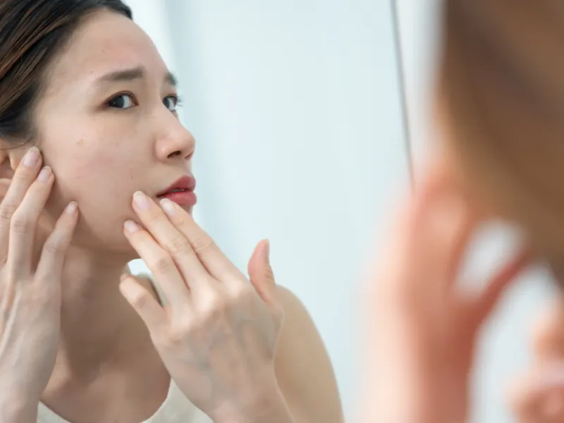 Hydrated silica gây bít tắc lỗ chân lông