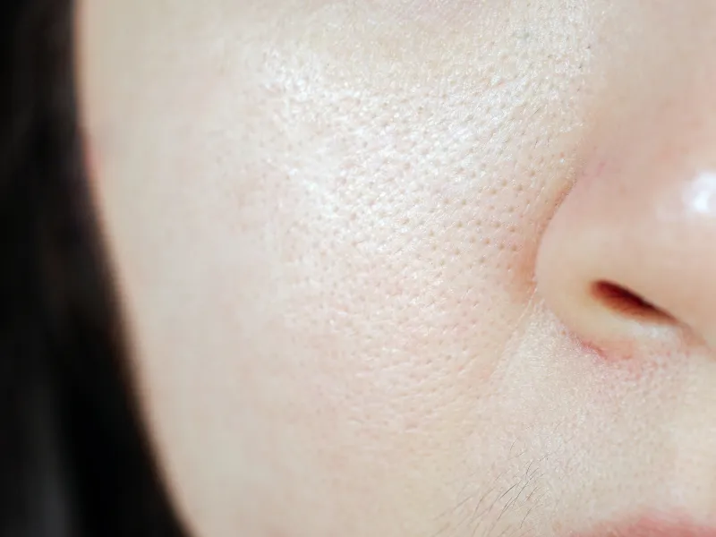 Ai nên và không nên dùng hydrated silica là gì?