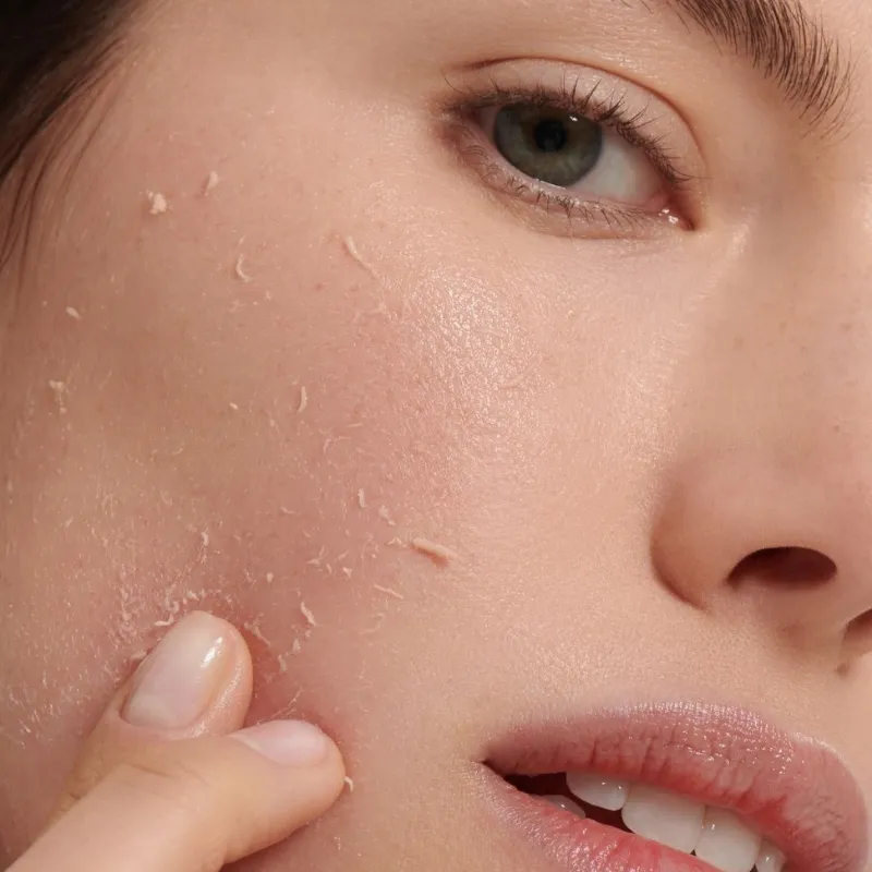 Đặc điểm của làn da khô nhạy cảm