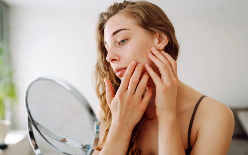 Thay đổi hormone ảnh hưởng đến da. Sau sinh 1 tháng có dùng được mỹ phẩm không?