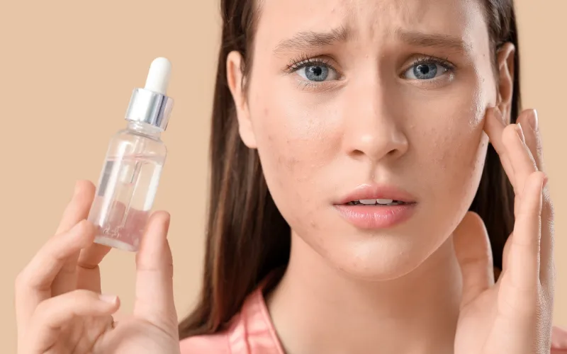 Nhóm Retinoids và dẫn xuất vitamin A