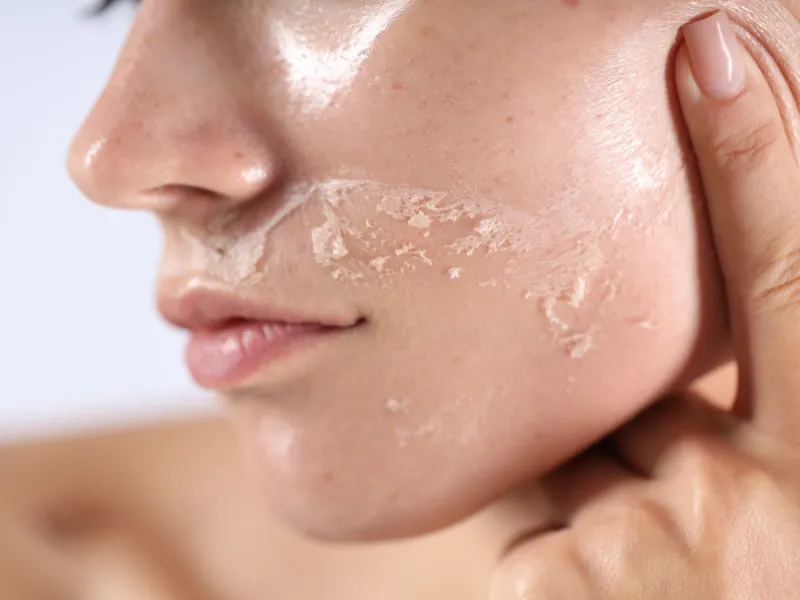 biotin pòng ngừa tình trạng da khô, bong tróc