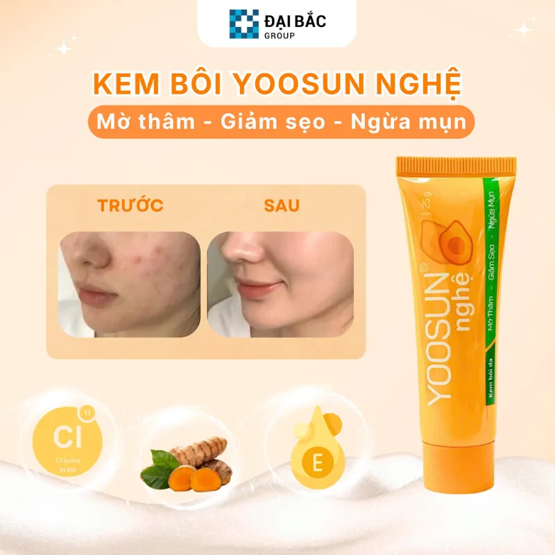 Những vấn đề da Yoosun Nghệ có thể giúp cải thiện