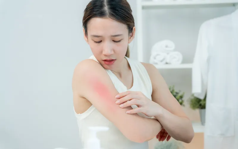 Hiểu rõ về tình trạng bệnh da nhạy cảm ánh sáng