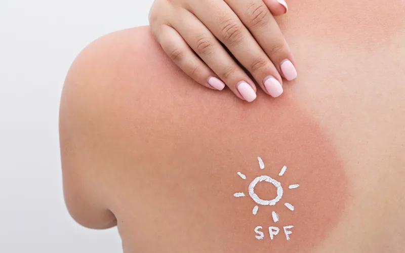 Cách dùng các sản phẩm hỗ trợ bảo vệ da