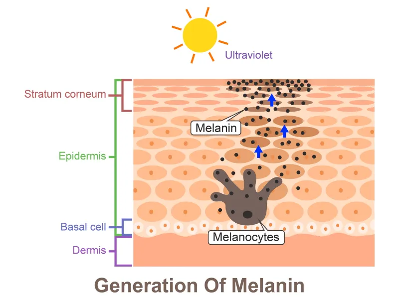 Nguyên nhân khiến da không đều màu