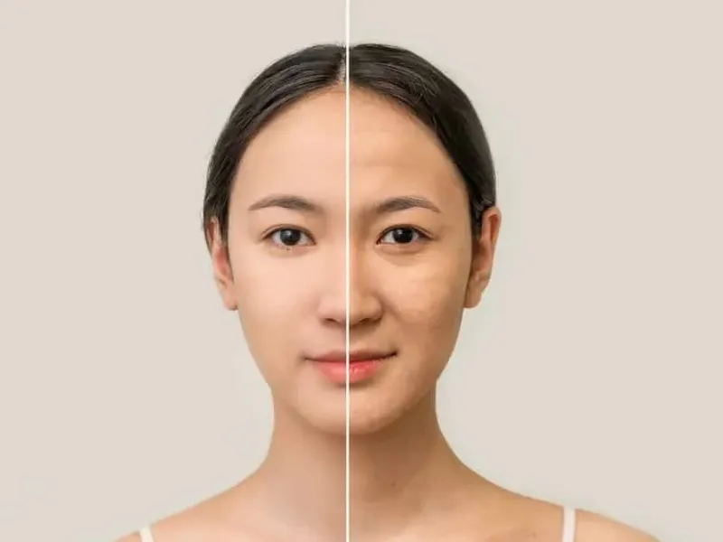 Da lão hoá sớm là gì?