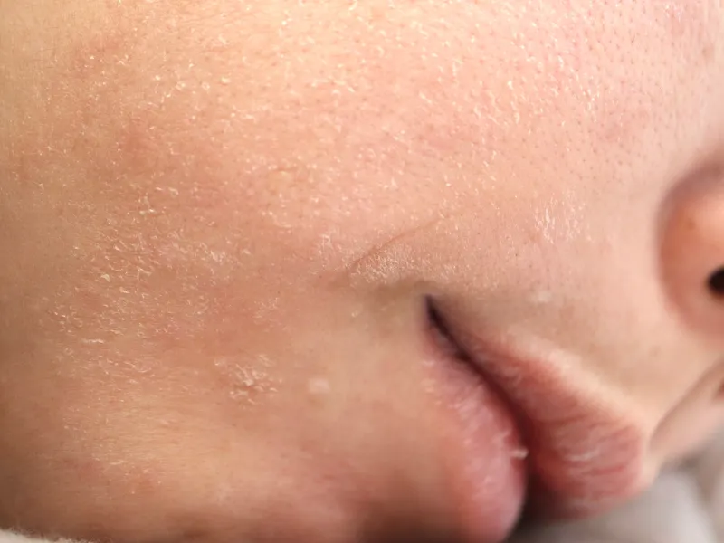 10 dấu hiệu nhận biết da lão hoá sớm